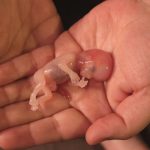 Abortusz: egy “választás”, amely a legtöbb ember halálát okozza a világon